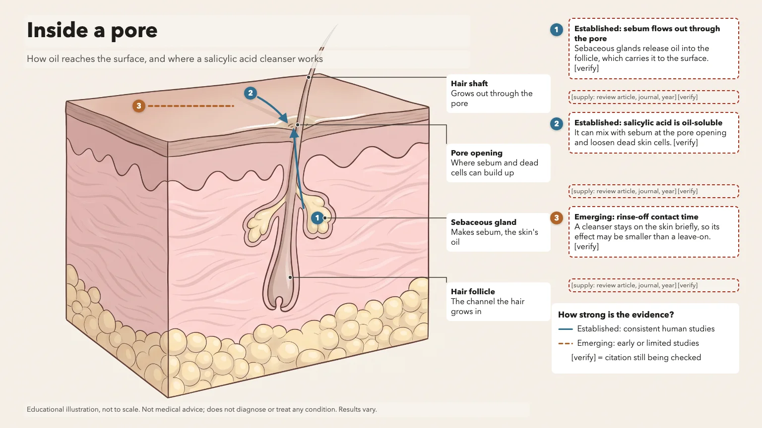 Skin cross-section titled Inside a pore, showing a hair follicle, sebaceous gland and pore opening with arrows and evidence cards about a salicylic acid cleanser
